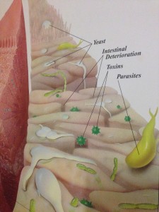 Right side shows and unhealthy intestinal surface